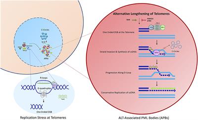 Alternative Lengthening of Telomeres in Pediatric Cancer: Mechanisms to Therapies